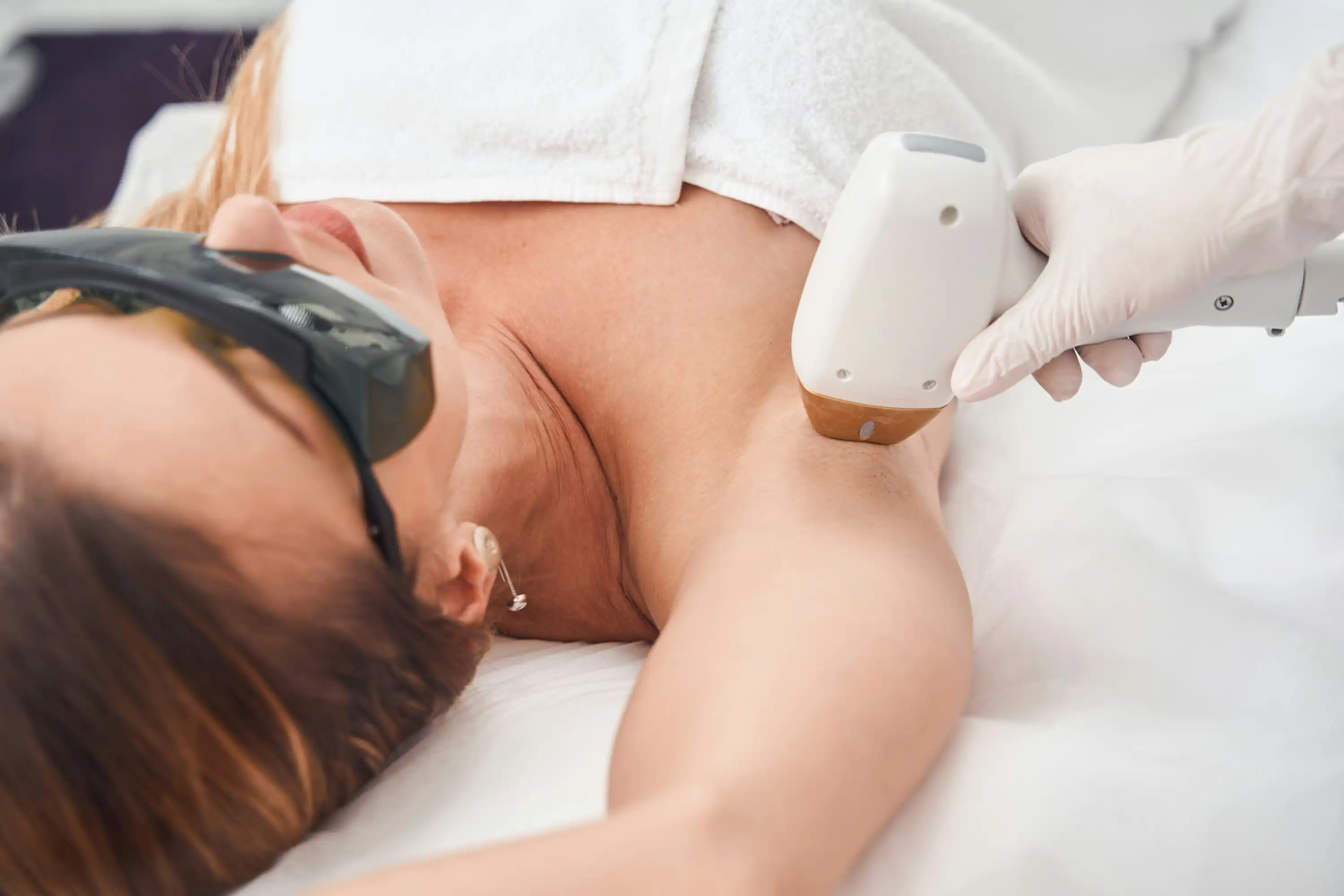 IPL-Laserbehandlung Haarentfernung World of Aesthetic Prof. Dr. Christian Weinand Hamburg
