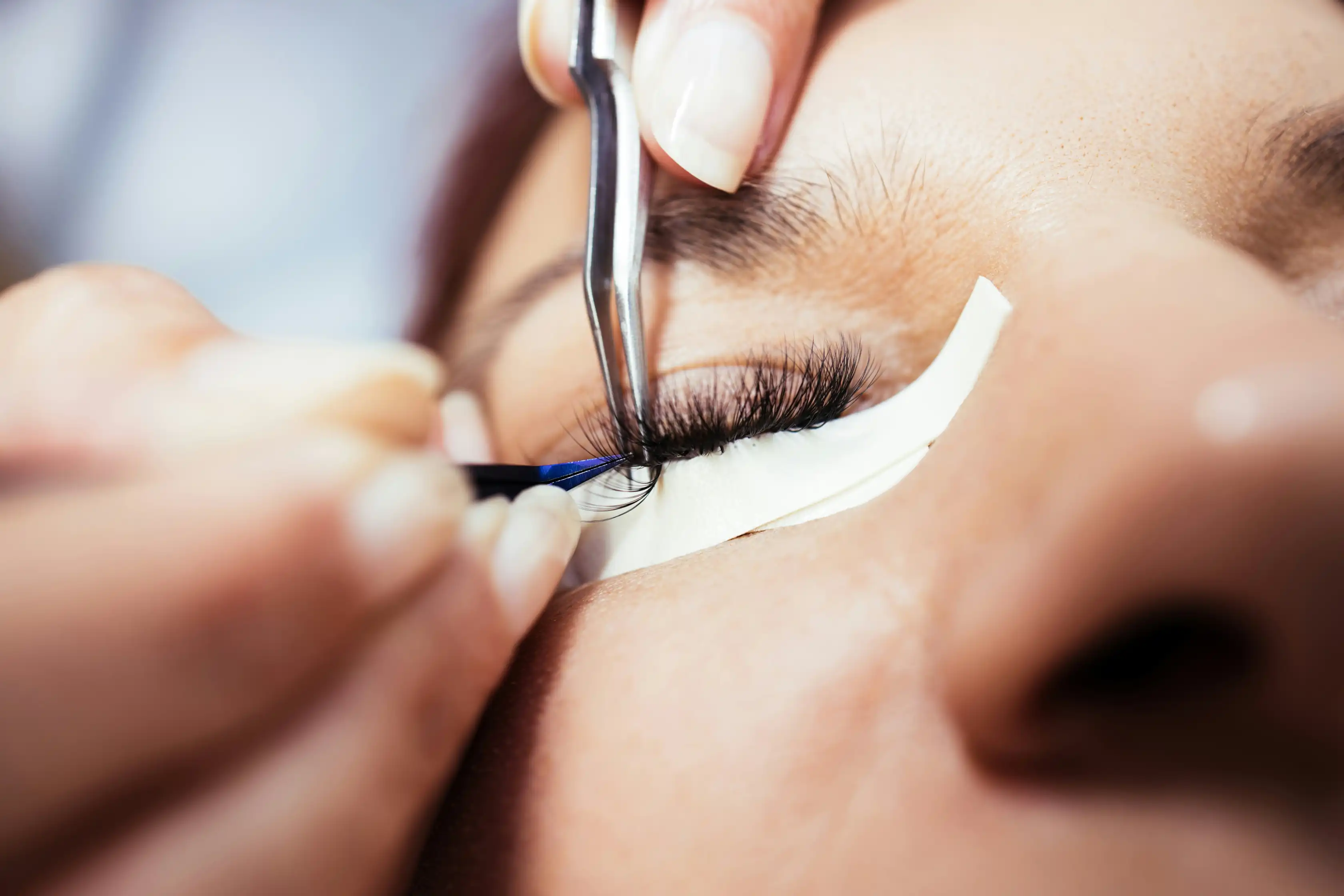 Gesichtslifting Prof. Dr. Christian Weinand World of Aesthetic Hamburg